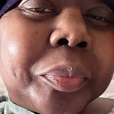 Fundraiser by Latoya Spencer : Life after stemcell transplant