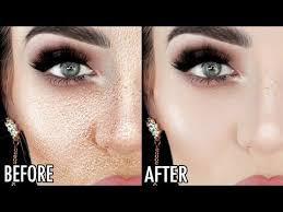 Pin By Veronica Smith On Beauty Tips Flaking Skin Skin Makeup Cake Face Makeup