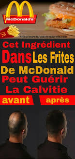 Cet Ingredient Dans Les Frites De Mcdonald Peut Guerir La Calvitie Playbill Mcdonald Movie Posters
