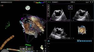 Bildergebnis für Morris Zerner