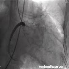 @miamiheartdr's video Tweet