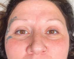 Dramatic lash transformation at E G Esthetics