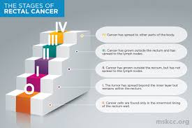 Cancer in children is not common, but it's important to have your child checked by a doctor if they have unusual signs or symptoms that do not go away, such as: Stages Of Rectal Cancer Memorial Sloan Kettering Cancer Center