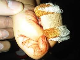 Maybe you would like to learn more about one of these? Ketika Tangan Kecil Itu Berdarah Pinky Polka