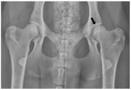Canine Hip Dysplasia Texas A M Veterinary Medical Teaching Hospital