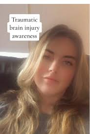 Lance Adams from Respiratory Failure