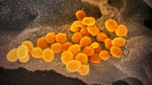 The patient was discharged home with oral antibiotics. Coronavirus Is Most Contagious Before During First Week Of Symptoms Science News