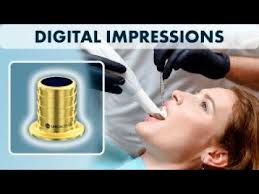 The difference between different types of multi units that you can use and  different types of screw