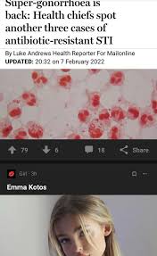 Emma Kotos - 9GAG