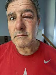 Fundraiser for Totress Beasley, Altadena Fire Victim