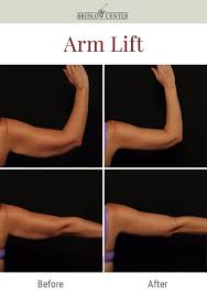 Pin On Before After Plastic Surgery