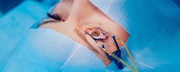Vision complications can be disruptive and uncomfortable, no matter who you are or what you do. Can You Get Prk After Lasik Eye Center Of Texas