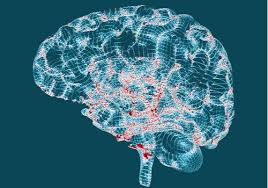 Huntington's disease, or hd, is an inherited neurodegenerative disorder in which brain cells are damaged and die over time, leading to progressive loss of mental and physical abilities. Die Huntington Krankheit Merkmale Und Anzeichen Gedankenwelt