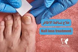 علاج تساقط الأظافر في الغردقة -احجز الآن-مركز نضارة