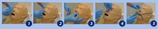 This is called a flashback, and it signals that you have entered a vein. Suctioning Physiopedia