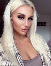 Mother-of-two 'addicted' to face fillers left 'deformed' after her lips  swelled into a beak and began to rot away