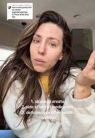 Replying to @traciebeer Possible answers to why my eyelashes are falling  out! 👁️ #alopeciaareata