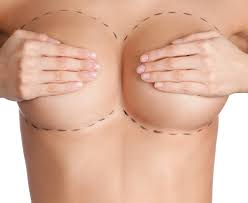 Enhance Your Breast Augmentation Results | Dr. Arthur Cambeiro
