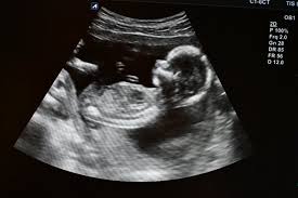 Image result for Ultrasound