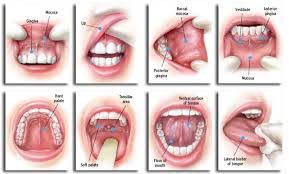 Where you first had it. Oral Cancer Symptoms Types And Risk Factors