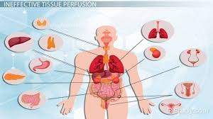 Seventeen judges nurses evaluated the clinical indicators of nursing outcomes, according to noc for patients on risk for ineffective cerebral tissue perfusion. Ineffective Tissue Perfusion Definition Risk Biology Class Video Study Com