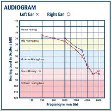 What Does 4000 Hz Tell You About A Childs Hearing