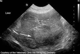 When symptoms do appear, they can mimic the signs of other diseases and conditions, making it. Liver Cancer Enpevet