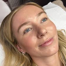 Kirsten at Dermalounge