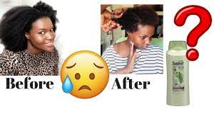The same old suave shampoo hair loss story. Suave Shampoo Ruined My Hair Youtube