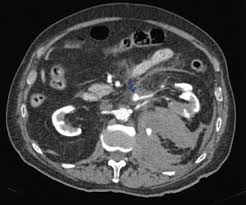 Image result for Genitourinary Trauma