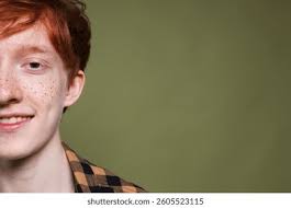 10+ Thousand Ginger Skin With Freckles Royalty-Free Images, Stock Photos &  Pictures