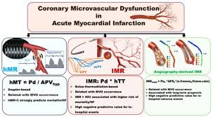 Image result for Myocardial Infarction Stabilization
