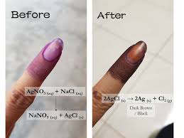 Cara terampuh untuk menghilangkan jerawat di bagian tubuh manapun termasuk jerawat di punggung ialah dengan menggunakan lemon. Kenapa Jari Mengundi Makin Gelap Pekat Ini Sebabnya Sayidahnapisahdotcom