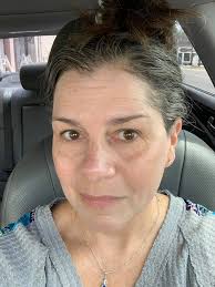 While I'm not supposed to have favorites, I must admit that I enjoy working  with Ladell Green. Her trust in the process and her commitment to achieving  her skin goals are truly