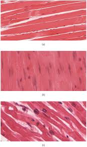 Usually derived from latin, a muscle's name often tells you something about the many muscle names indicate the muscle's location. Types Of Muscle Tissues Anatomy And Physiology
