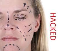 Cosmetic Surgery Clinic Hit By Hackers Plastic Surgery Cosmetic Surgery Cosmetic Surgeon