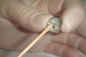 Check spelling or type a new query. Full Coverage Restoration For Primary Molars Pocket Dentistry