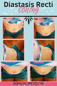 Diastasis Recti What Not To Do Coning Doming Certain Exercises Can Make The Separation Worse H Diastasis Recti Diastasis Recti Exercises Post Partum Workout
