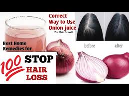 Coconut oil contains the necessary proteins and medium chain fatty acids to help accomplish both of those goals, so it is an excellent home remedy to try out. 7 Days Only Hair Fall Solution Hair Fall Solution At Home 100 Effective Youtube