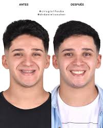 Daniel Roscher Ortognática Maxilofacial