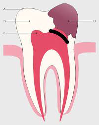 Pin On Dental Info