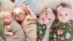 We Were Literally One In A Million Identical Twins With Down Syndrome Happens Once Out Of Every Million Pregnancies We Had Been Chosen For This Task Love What Matters
