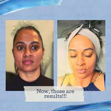 TOP 10 BEST Chin Waxing in Lakewood Ranch, FL