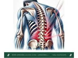 Image result for Vertebral Compression Fracture
