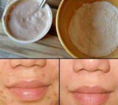 Pin On Masque Beaute