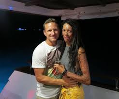 Turia Pitt And Michael Hoskin S Amazing Love Story In Pictures Love Story Michael True Life