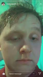 Lewis Capaldi at Elrow 😂😂