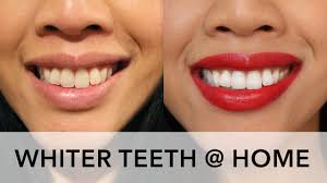 Whiter Teeth At Home White With Style Review Youtube Maintaining beautiful white teeth can be a challenge if you enjoy drinking tea, coffee, red wine, or you smoke cigarettes. whiter teeth at home white with style review
