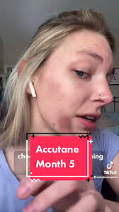 Accutane 5-Month Update: Progress and Results