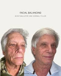 Danielle P. RN, BSN (@danielle.injects) • Instagram photos and videos